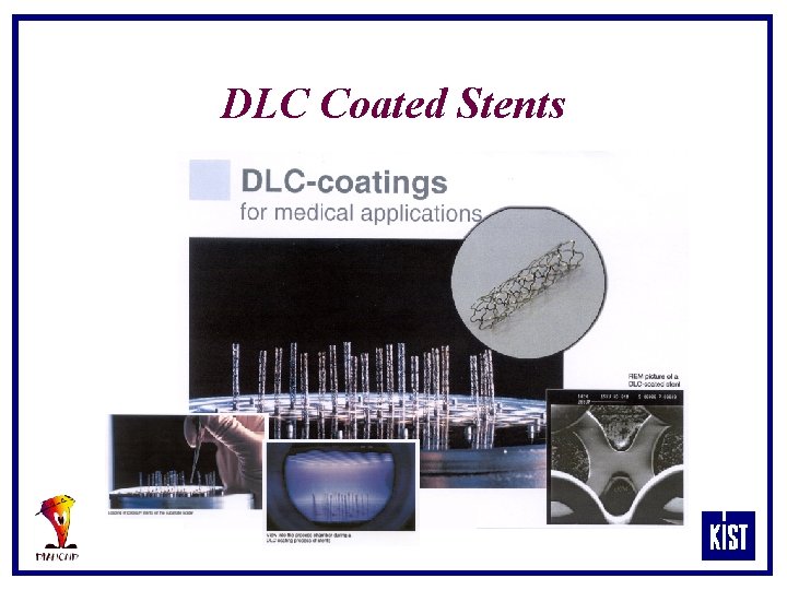 DLC Coated Stents 