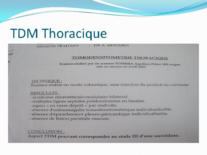 TDM Thoracique TDM Thoracique