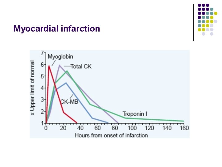 Myocardial infarction 