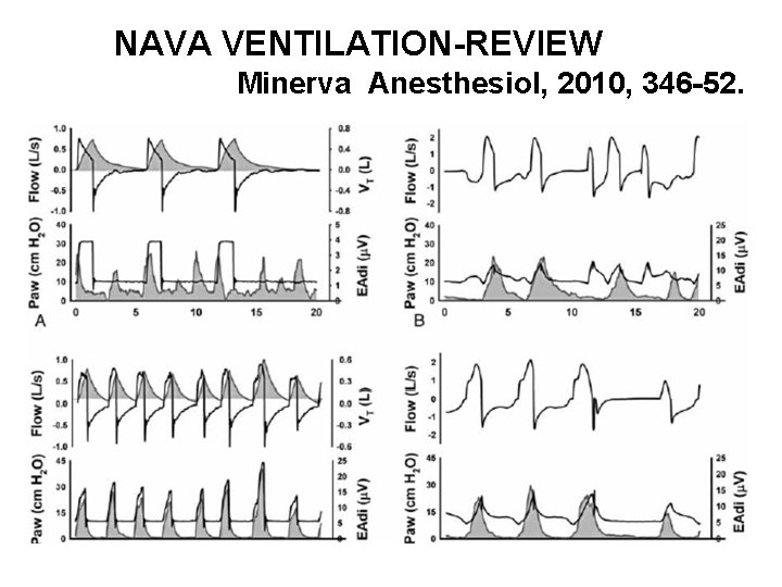NAVA VENTILATION-REVIEW Minerva Anesthesiol, 2010, 346 -52. 