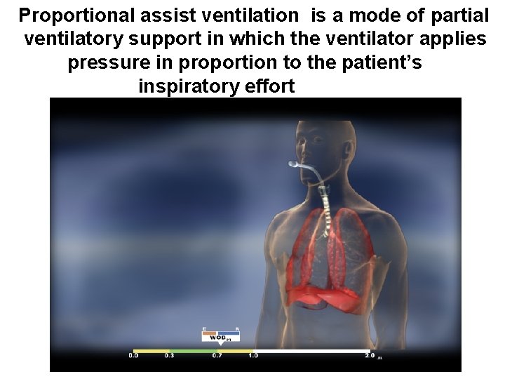 Proportional assist ventilation is a mode of partial ventilatory support in which the ventilator