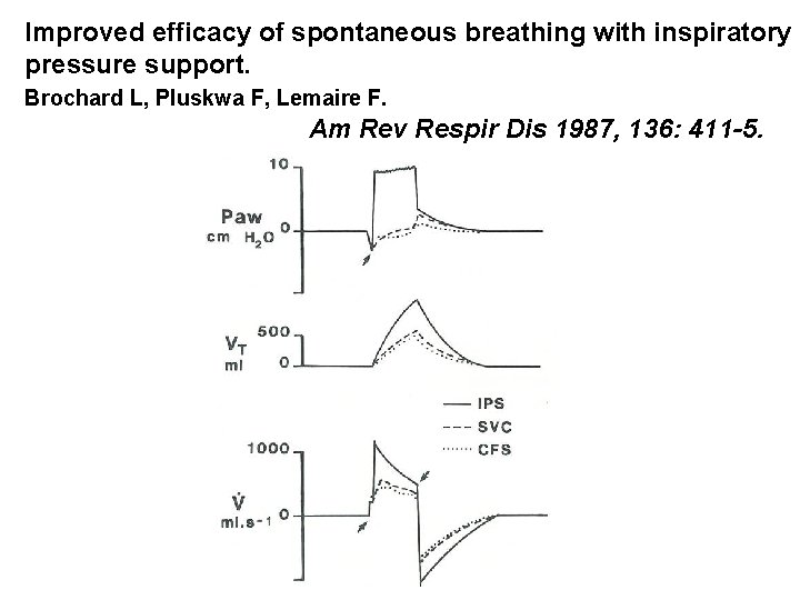 Improved efficacy of spontaneous breathing with inspiratory pressure support. Brochard L, Pluskwa F, Lemaire