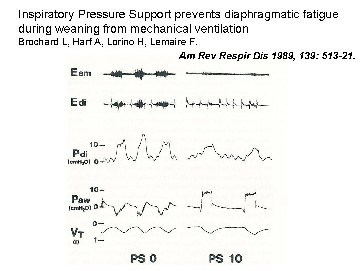 Inspiratory Pressure Support prevents diaphragmatic fatigue during weaning from mechanical ventilation Brochard L, Harf