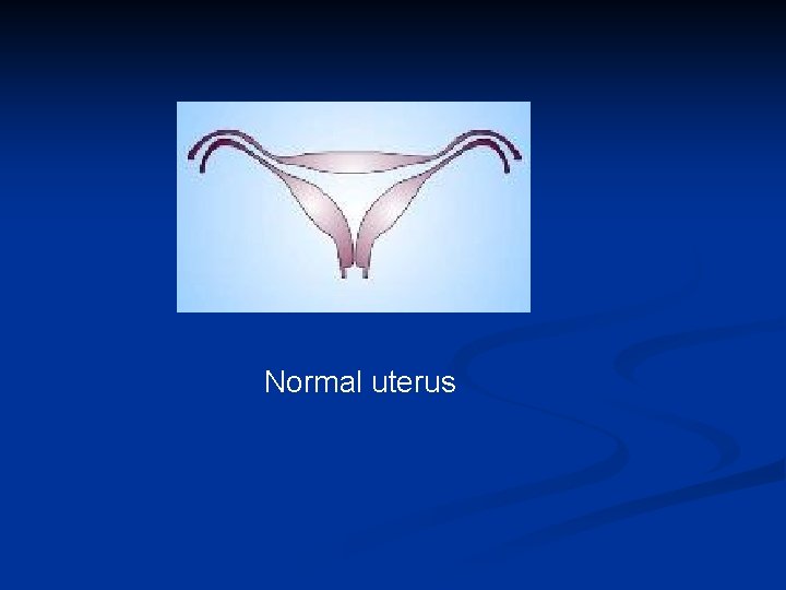 Normal uterus 