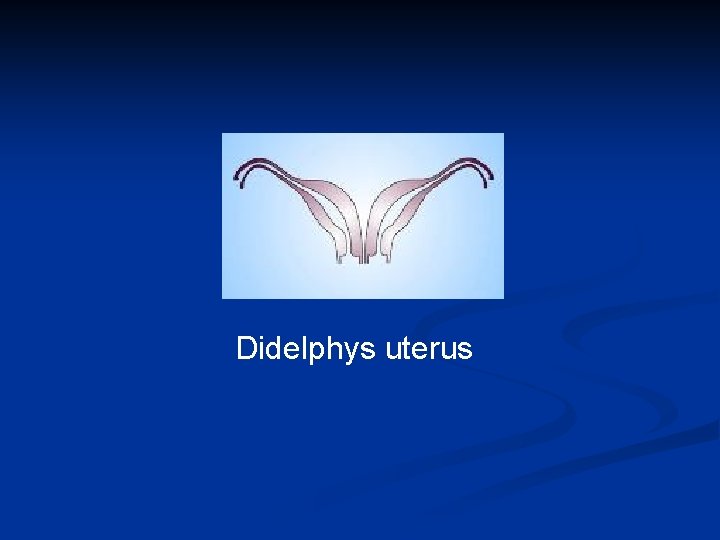 Didelphys uterus 