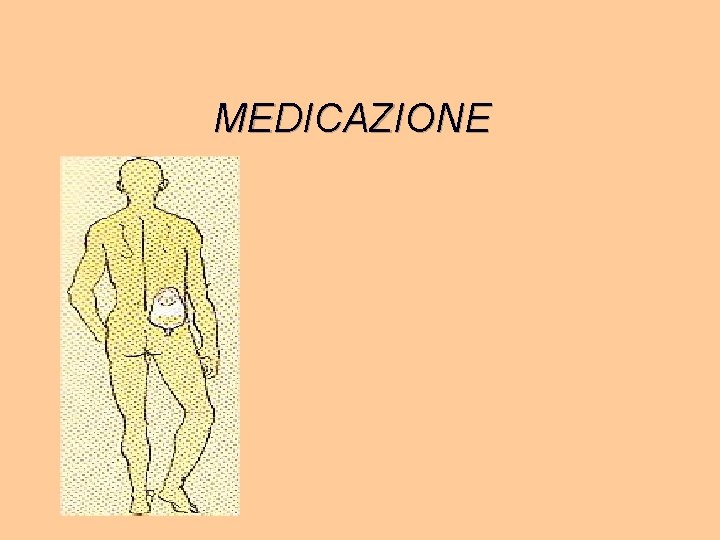 MEDICAZIONE 