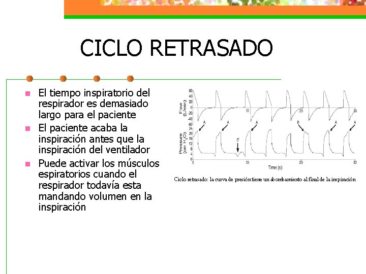 CICLO RETRASADO n n n El tiempo inspiratorio del respirador es demasiado largo para