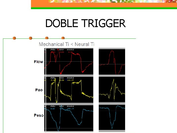 DOBLE TRIGGER 