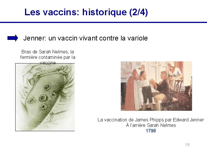 Les vaccins: historique (2/4) Jenner: un vaccin vivant contre la variole Bras de Sarah