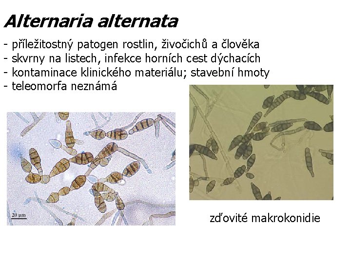 Alternaria alternata - příležitostný patogen rostlin, živočichů a člověka skvrny na listech, infekce horních