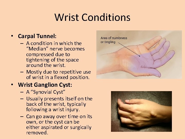 Wrist Conditions • Carpal Tunnel: – A condition in which the “Median” nerve becomes