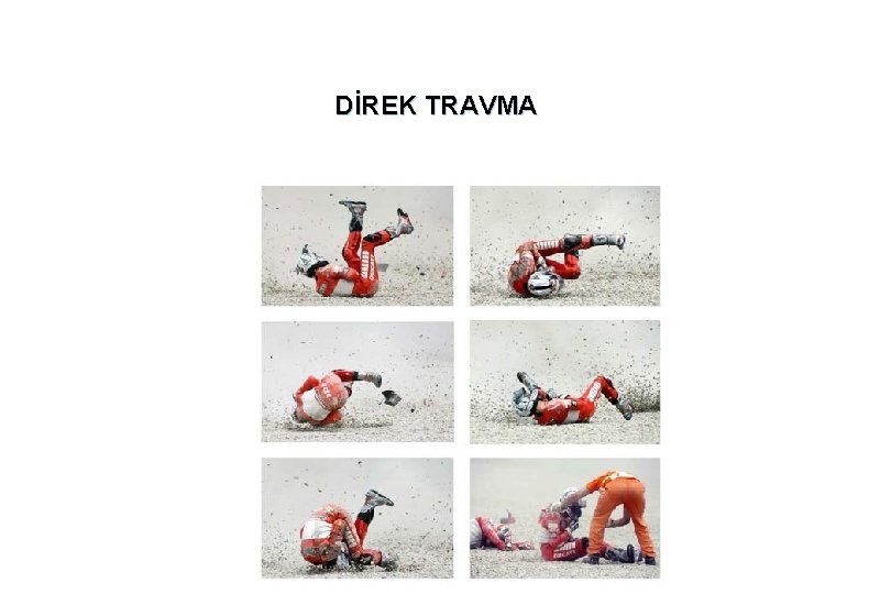 DİREK TRAVMA 