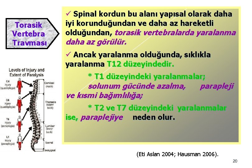 Torasik Vertebra Travması ü Spinal kordun bu alanı yapısal olarak daha iyi korunduğundan ve