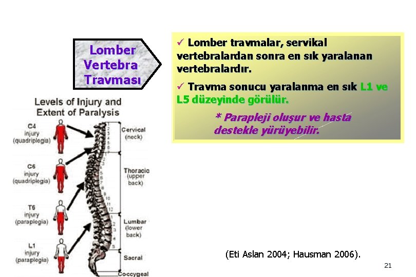 Lomber Vertebra Travması ü Lomber travmalar, servikal vertebralardan sonra en sık yaralanan vertebralardır. ü