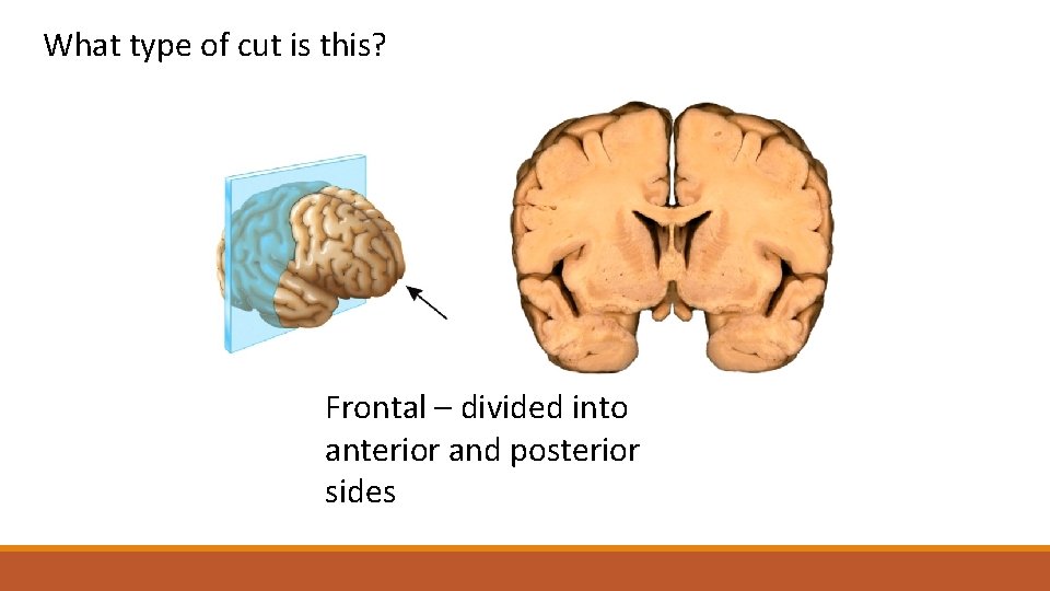 What type of cut is this? Frontal – divided into and posterior This is