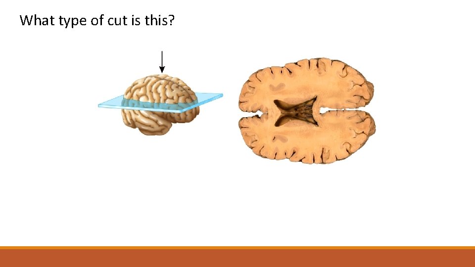 What type of cut is this? This is a ______ section of the brain.