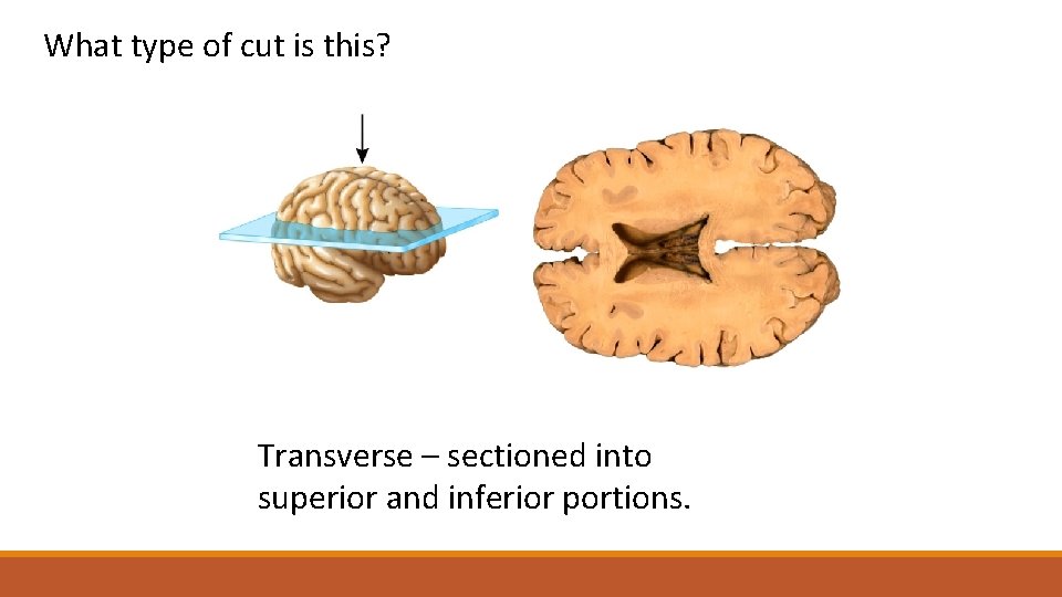 What type of cut is this? This Transverse is a ______ – sectioned section