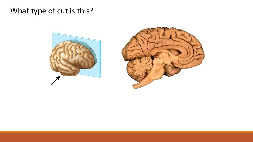 What type of cut is this? This is a ______ section of the brain.