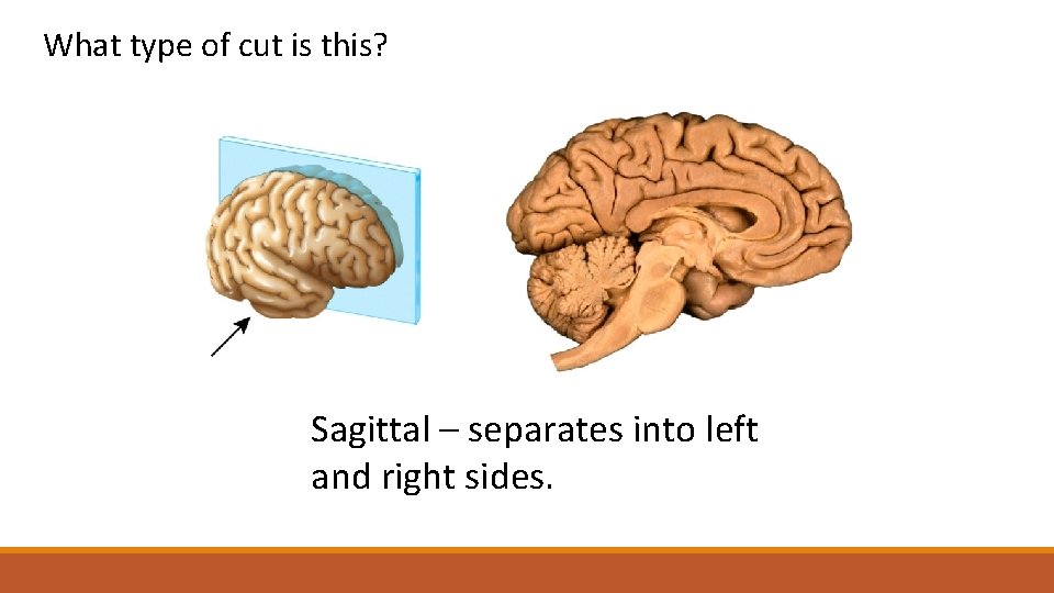 What type of cut is this? Sagittal – separates into left This is a