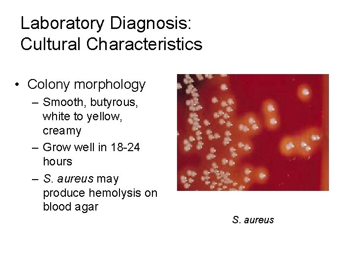 Laboratory Diagnosis: Cultural Characteristics • Colony morphology – Smooth, butyrous, white to yellow, creamy