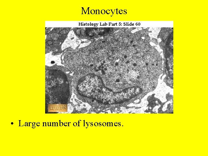 Monocytes • Large number of lysosomes. 