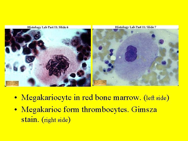 • Megakariocyte in red bone marrow. (left side) • Megakarioc form thrombocytes. Gimsza • Megakariocyte in red bone marrow. (left side) • Megakarioc form thrombocytes. Gimsza