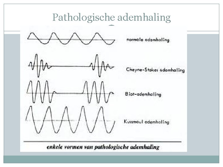 Pathologische ademhaling 