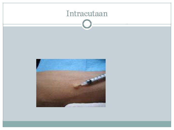 Intracutaan 