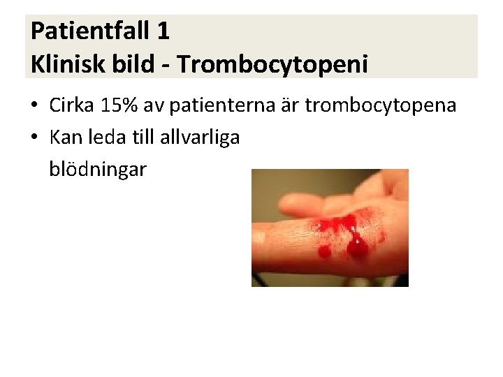 Patientfall 1 Klinisk bild - Trombocytopeni • Cirka 15% av patienterna är trombocytopena •