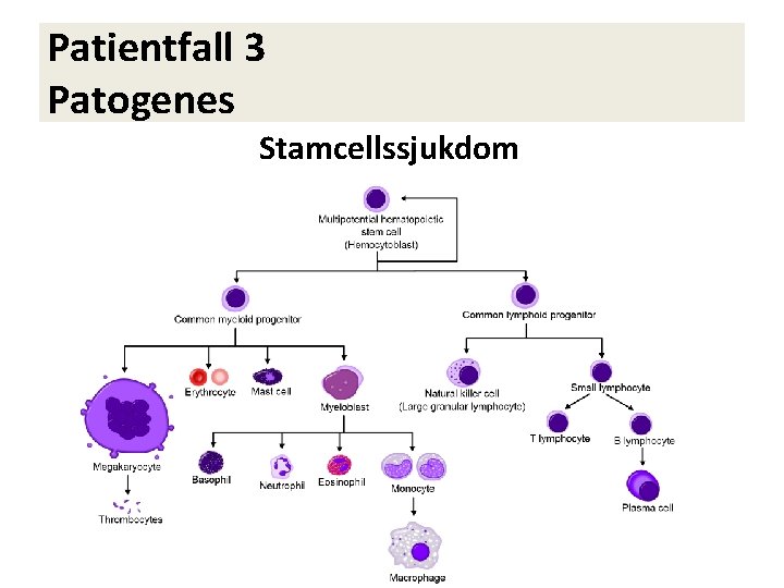 Patientfall 3 Patogenes Stamcellssjukdom 