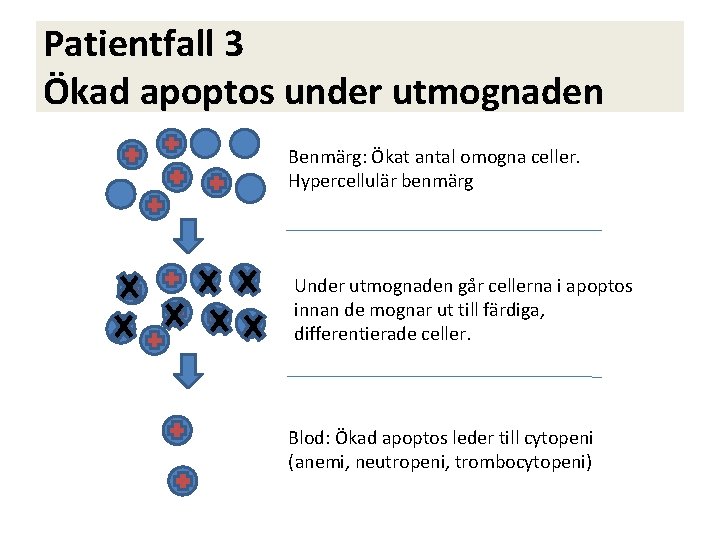 Patientfall 3 Ökad apoptos under utmognaden Benmärg: Ökat antal omogna celler. Hypercellulär benmärg Under