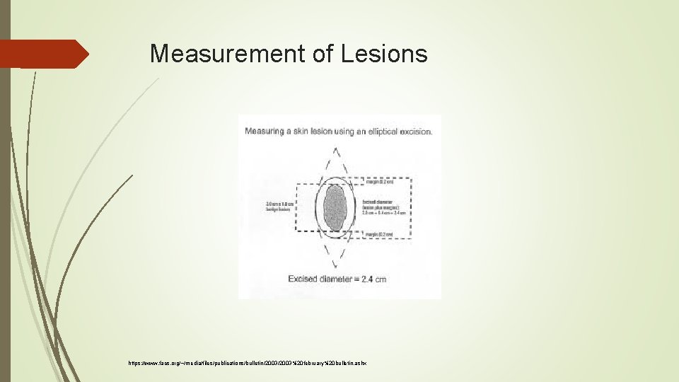 Measurement of Lesions https: //www. facs. org/~/media/files/publications/bulletin/2003%20 february%20 bulletin. ashx 