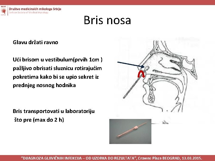 Bris nosa Glavu držati ravno Ući brisom u vestibulum(prvih 1 cm ) pažljivo obrisati