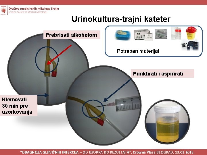 Urinokultura-trajni kateter Prebrisati alkoholom Potreban materijal Punktirati i aspirirati Klemovati 30 min pre uzorkovanja