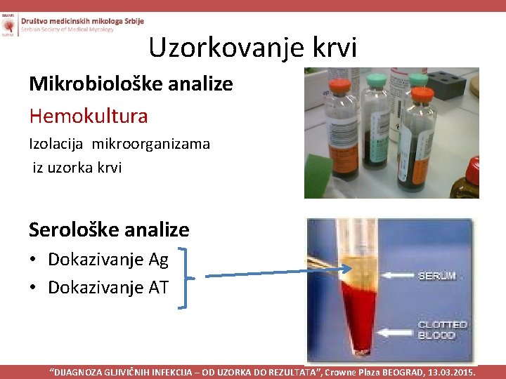 Uzorkovanje krvi Mikrobiološke analize Hemokultura Izolacija mikroorganizama iz uzorka krvi Serološke analize • Dokazivanje