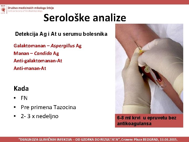 Serološke analize Detekcija Ag i At u serumu bolesnika Galaktomanan – Aspergillus Ag Manan