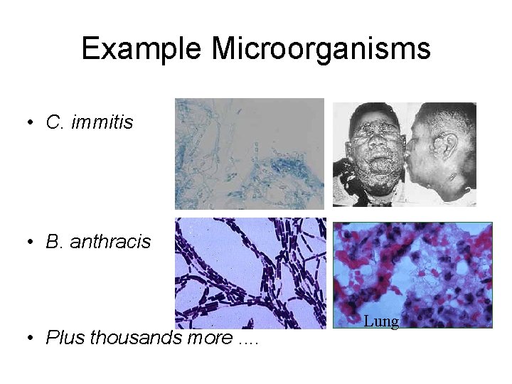 Example Microorganisms • C. immitis • B. anthracis • Plus thousands more. . Lung