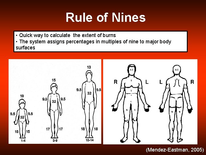 Rule of Nines • Quick way to calculate the extent of burns • The