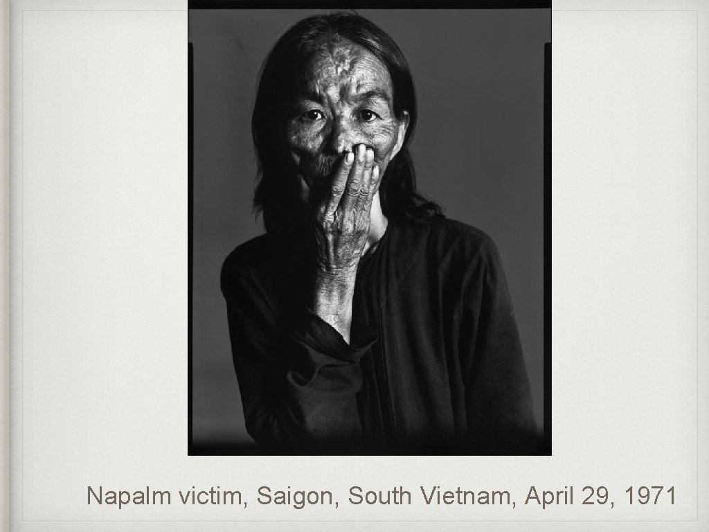 Napalm victim, Saigon, South Vietnam, April 29, 1971 