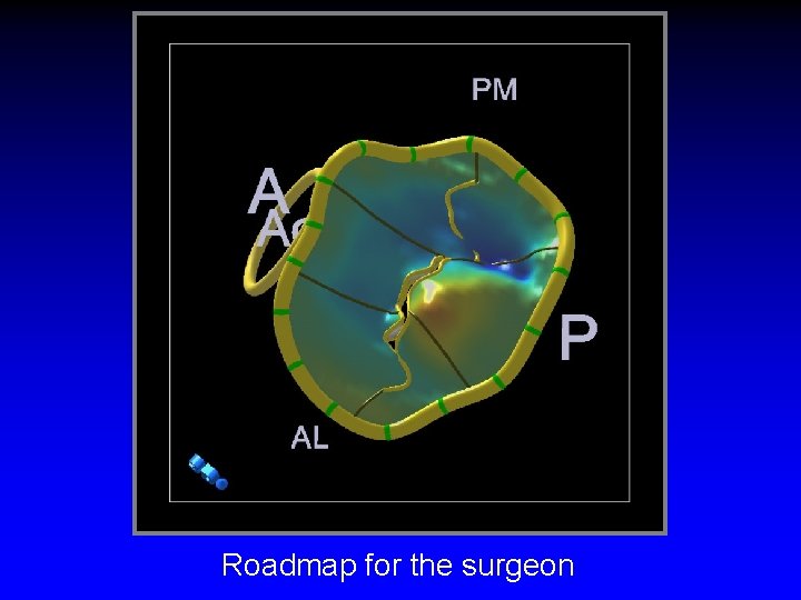 Roadmap for the surgeon 