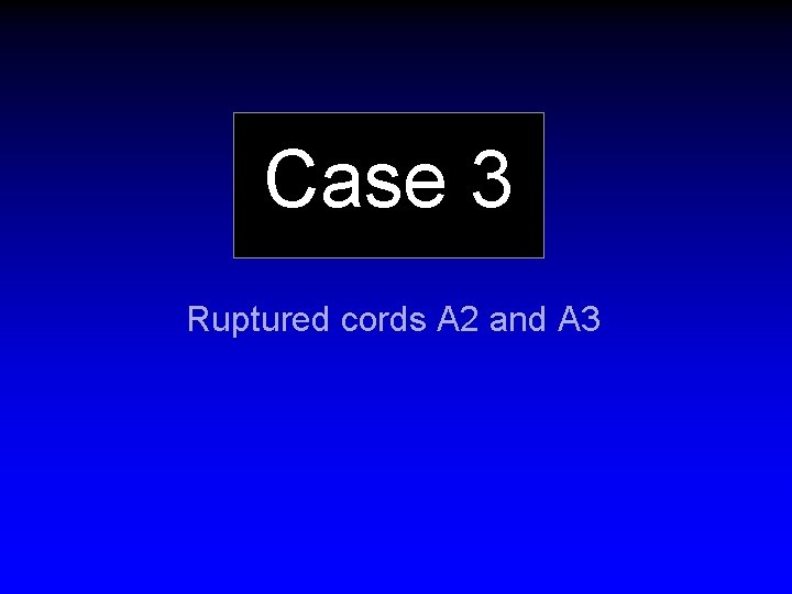 Case 3 Ruptured cords A 2 and A 3 