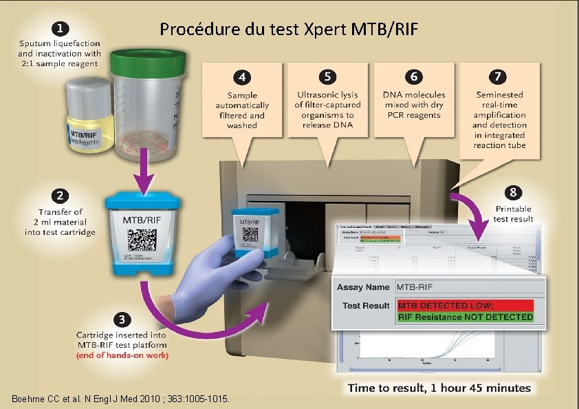 Procédure du test Xpert MTB/RIF -‹#›- CC et al. N Engl J Med 2010