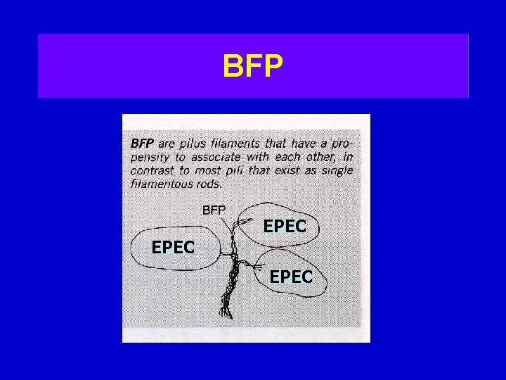 BFP EPEC 