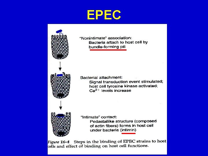 EPEC 