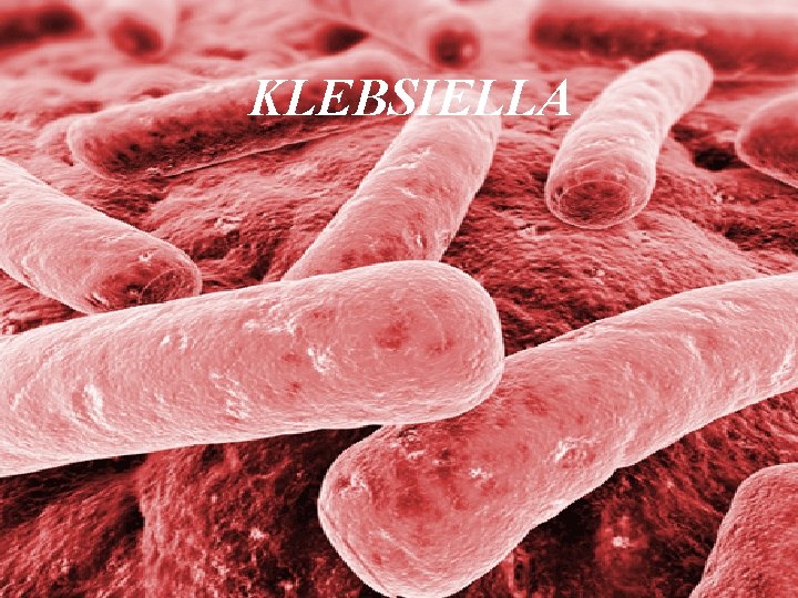 KLEBSIELLA 