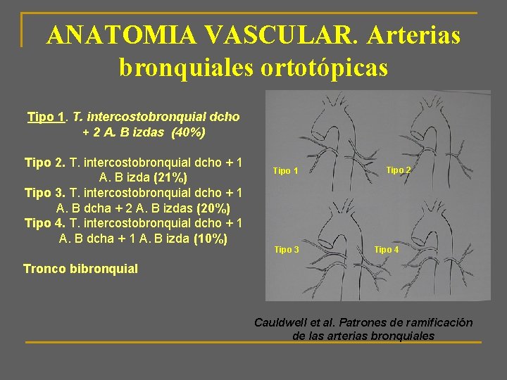 ANATOMIA VASCULAR. Arterias bronquiales ortotópicas Tipo 1. T. intercostobronquial dcho + 2 A. B