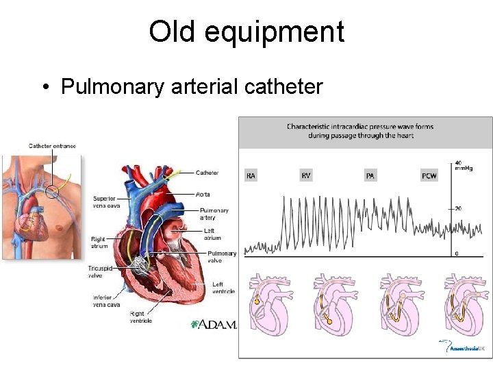 Old equipment • Pulmonary arterial catheter 