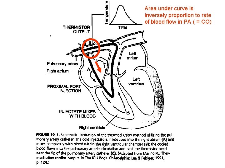 Area under curve is inversely proportion to rate of blood flow in PA (