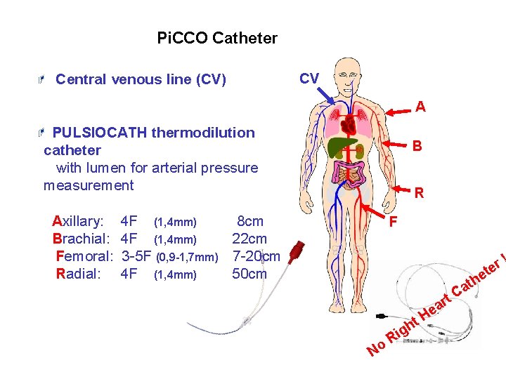 Pi. CCO Catheter Central venous line (CV) CV A PULSIOCATH thermodilution catheter with lumen