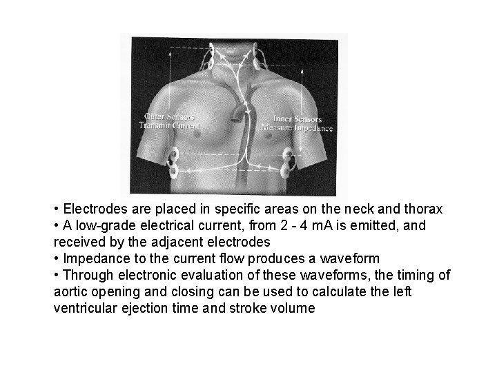  • Electrodes are placed in specific areas on the neck and thorax •